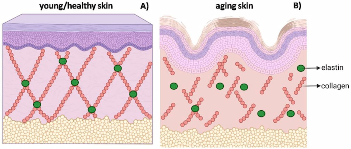 Uống Collagen Vô Dụng – Vậy Ăn Gì Đẹp Da? 3 Cấu trúc của làn da trẻ khỏe (A) và làn da lão hóa (B)