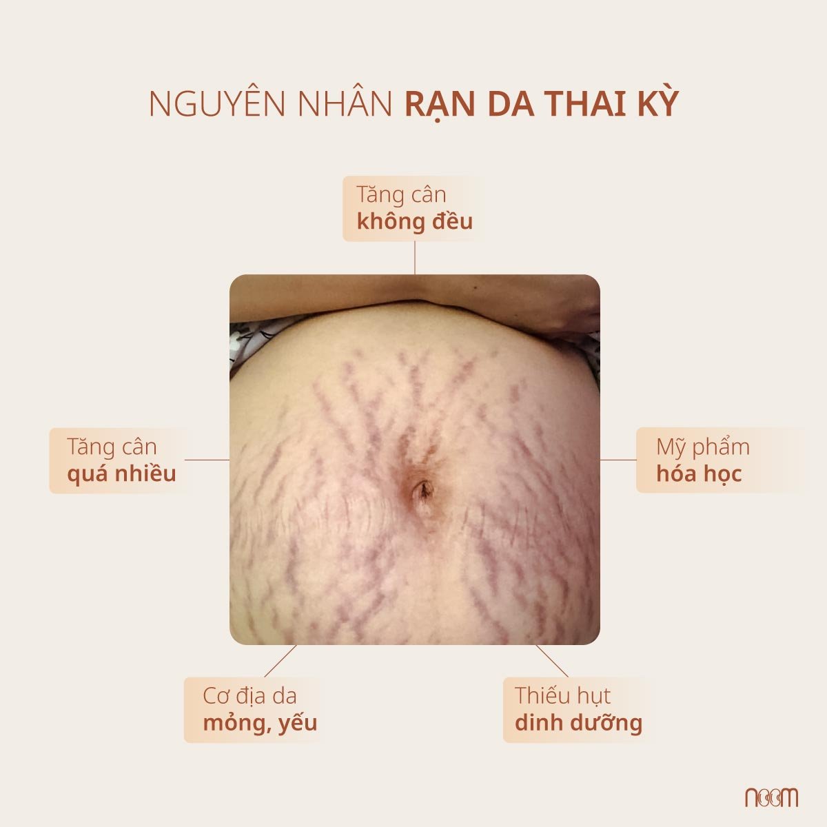 chong ran da cho ba bau 4