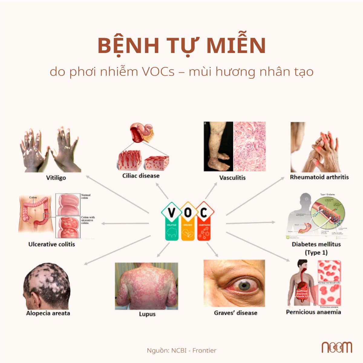 tac hai mui huong nuoc giat cho tre so sinh 4