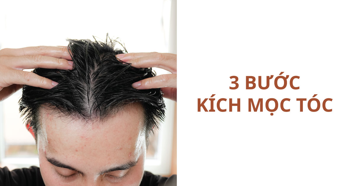 kích thích mọc tóc