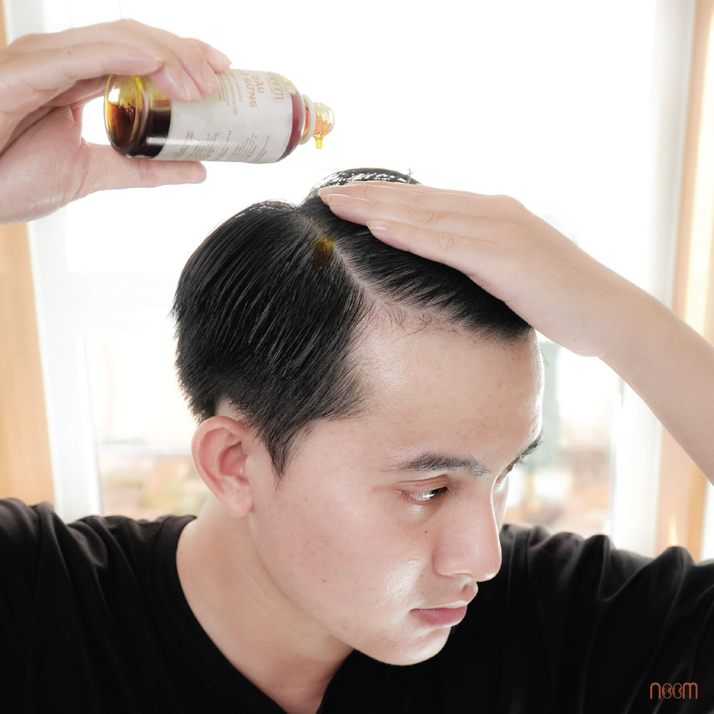 kích thích mọc tóc