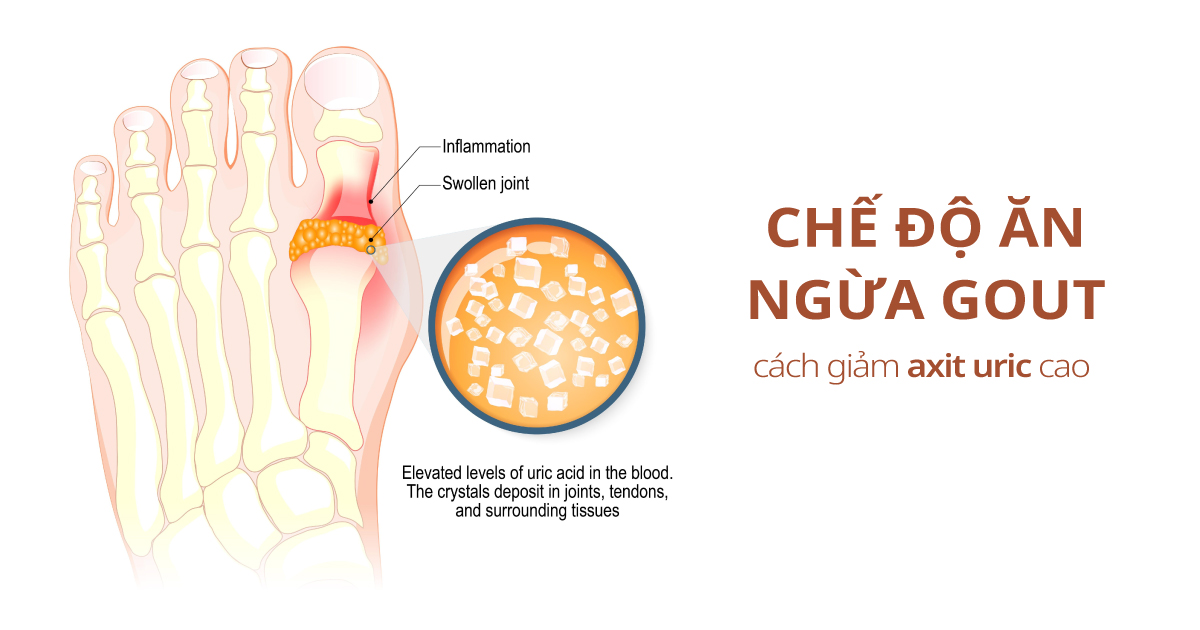 bệnh gout nên ăn gì