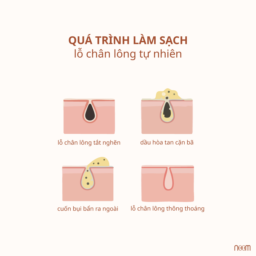 Lỗ Chân Lông To Bít Tắc – Càng Nên Oil Skincare 2 lỗ chân lông to